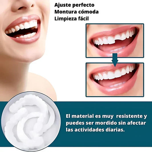 SmilePro – Carillas Dentales Ajustables + Estuche de regalo
