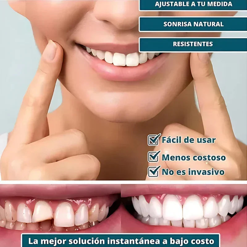 SmilePro – Carillas Dentales Ajustables + Estuche de regalo