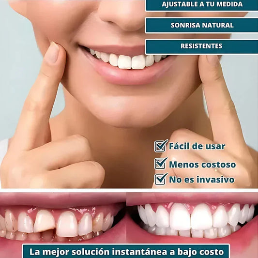 SmilePro – Carillas Dentales Ajustables + Estuche de regalo