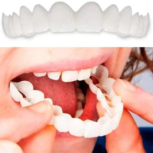 SmilePro – Carillas Dentales Ajustables + Estuche de regalo